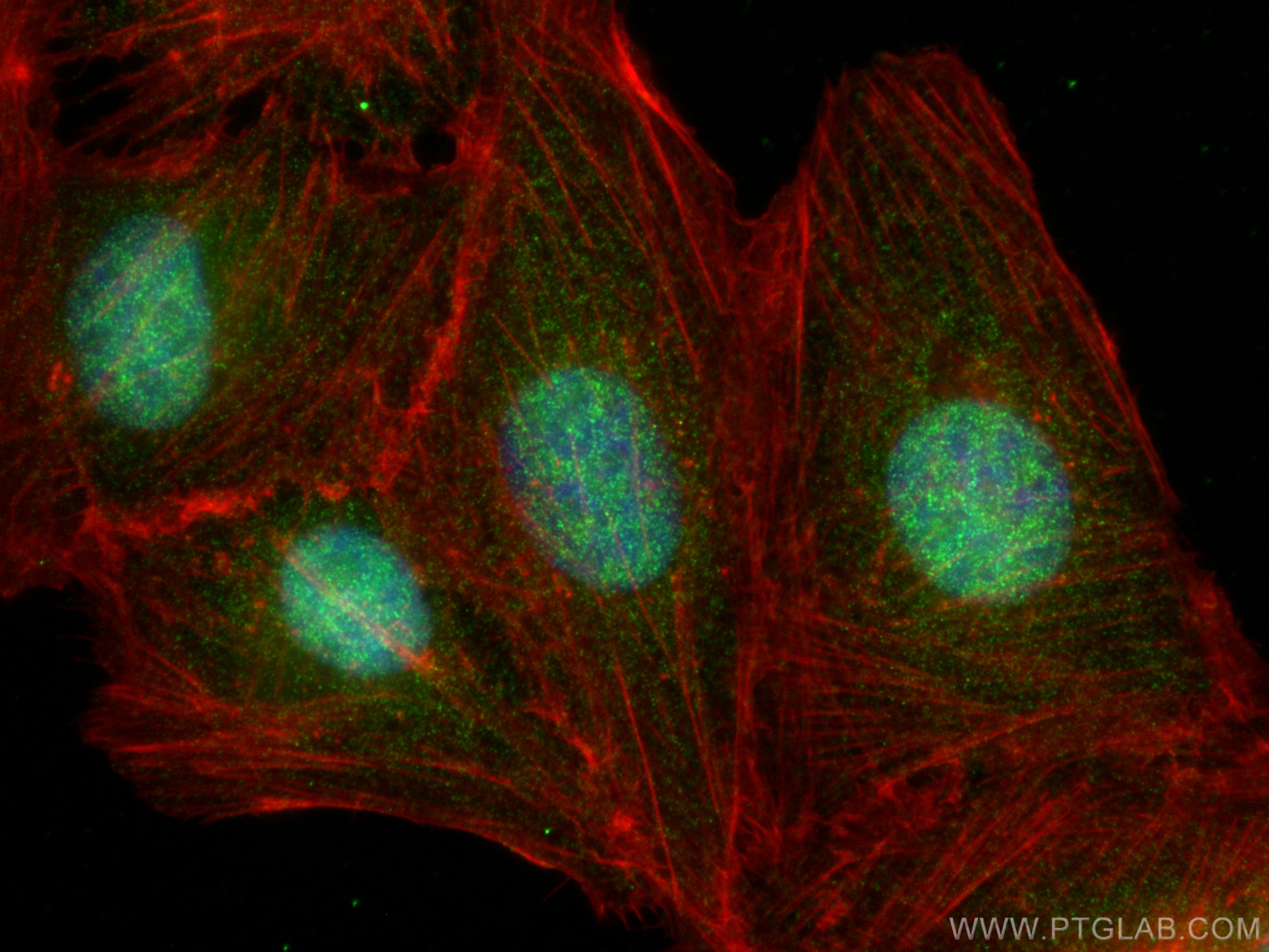 Immunofluorescence (IF) / fluorescent staining of U2OS cells using ABL1 Monoclonal antibody (68254-1-Ig)
