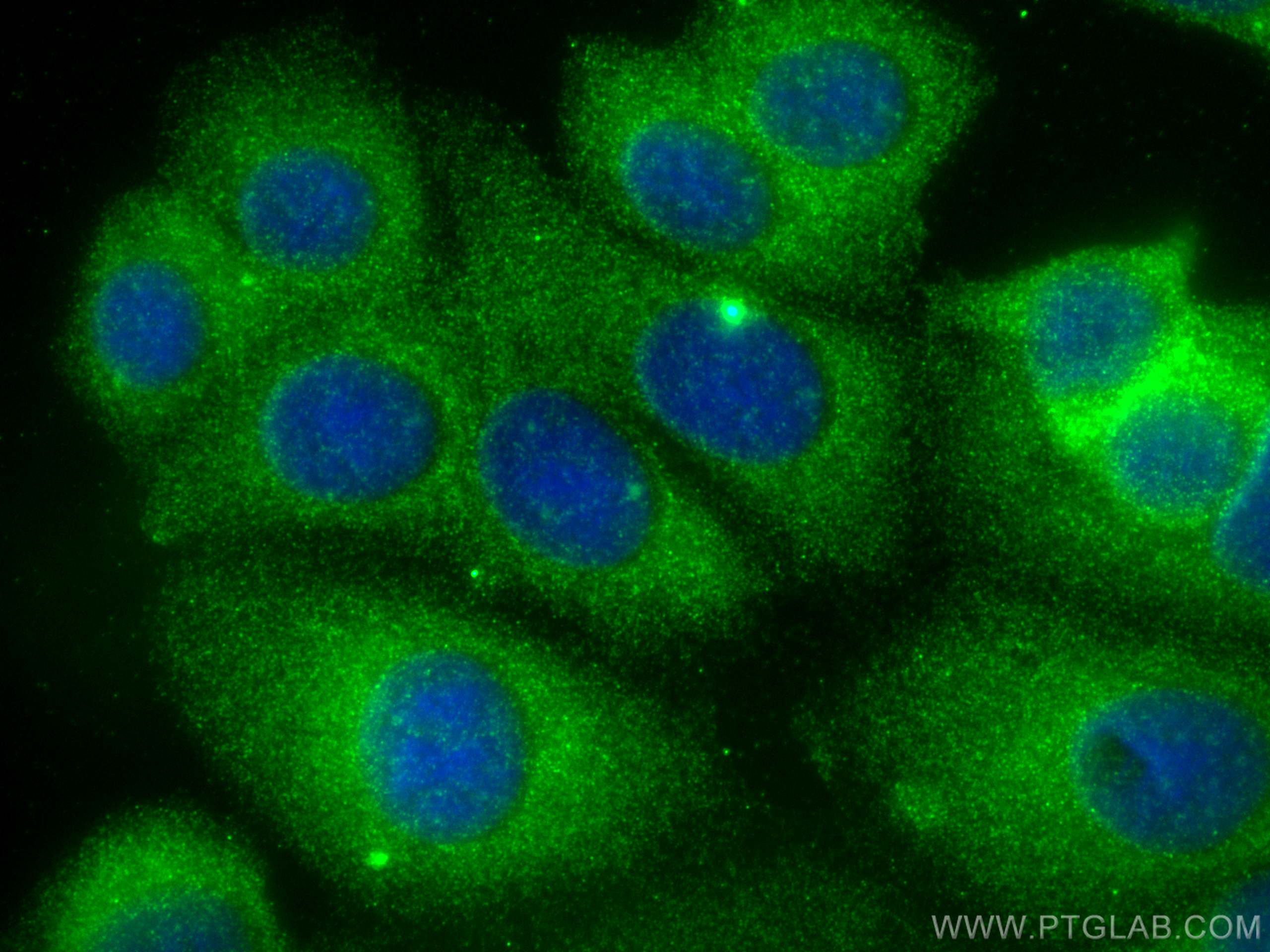 Immunofluorescence (IF) / fluorescent staining of MCF-7 cells using ABL1 Monoclonal antibody (68254-1-Ig)