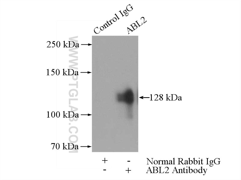 Immunoprecipitation (IP) experiment of HeLa cells using ABL2 Polyclonal antibody (17693-1-AP)