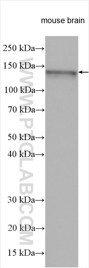 Western Blot (WB) analysis of various lysates using ABL2 Polyclonal antibody (17693-1-AP)