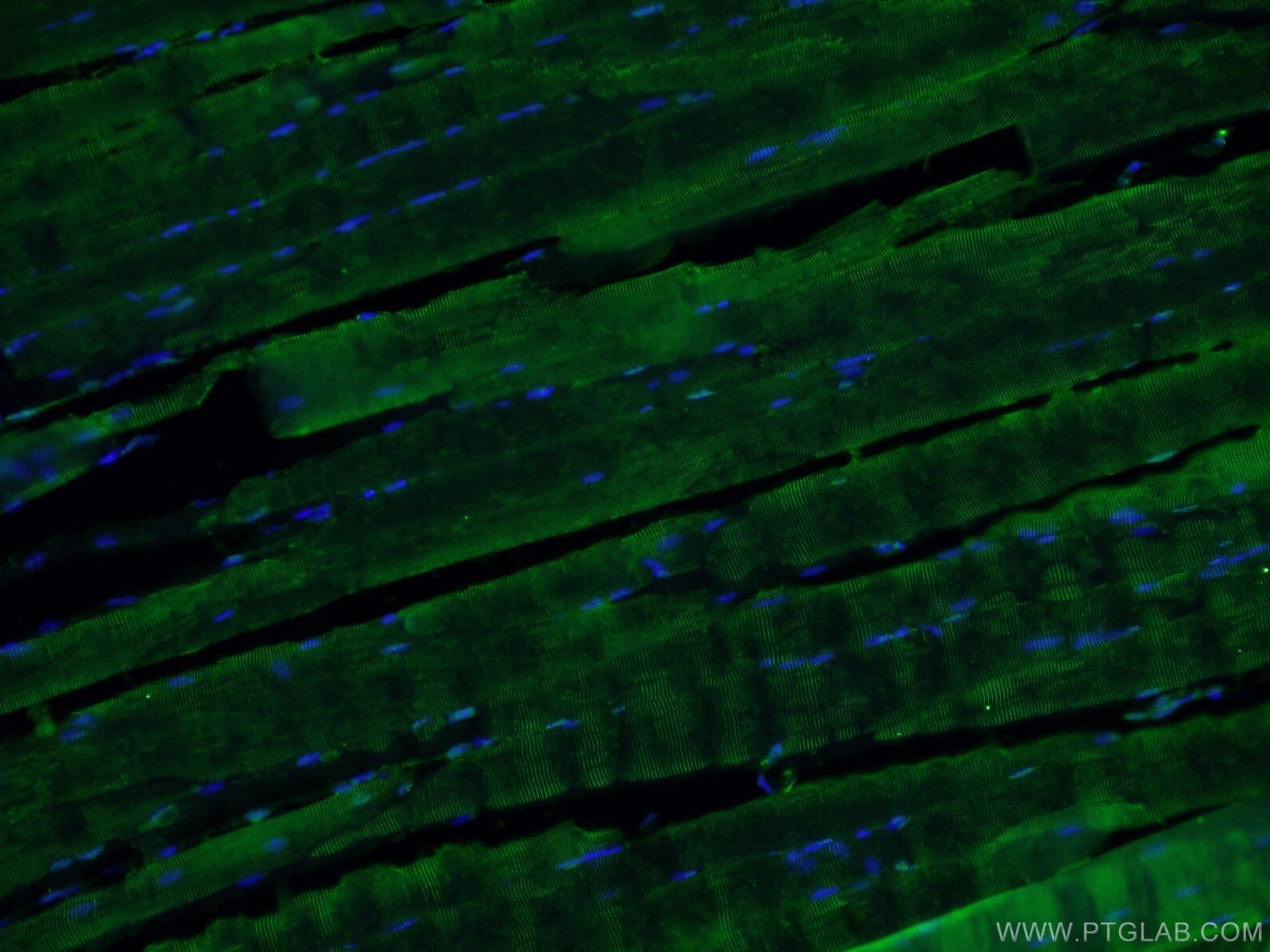 Immunofluorescence (IF) / fluorescent staining of mouse skeletal muscle tissue using ABLIM1 Polyclonal antibody (15129-1-AP)