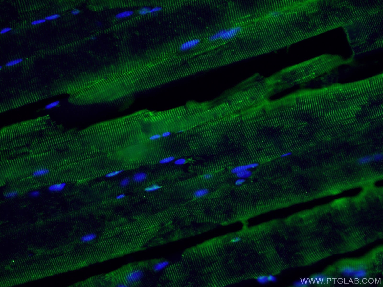 Immunofluorescence (IF) / fluorescent staining of mouse skeletal muscle tissue using ABLIM1 Polyclonal antibody (15129-1-AP)