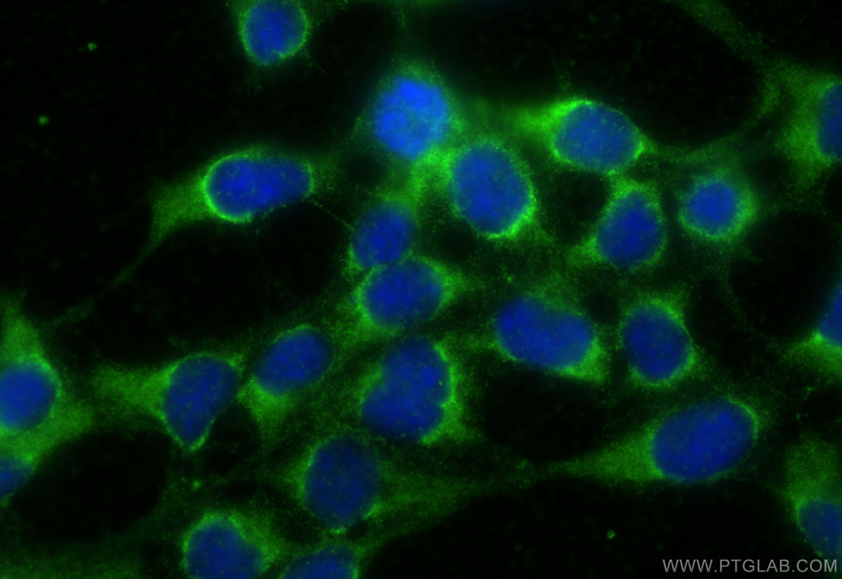 Immunofluorescence (IF) / fluorescent staining of HEK-293 cells using ABLIM1 Polyclonal antibody (15129-1-AP)