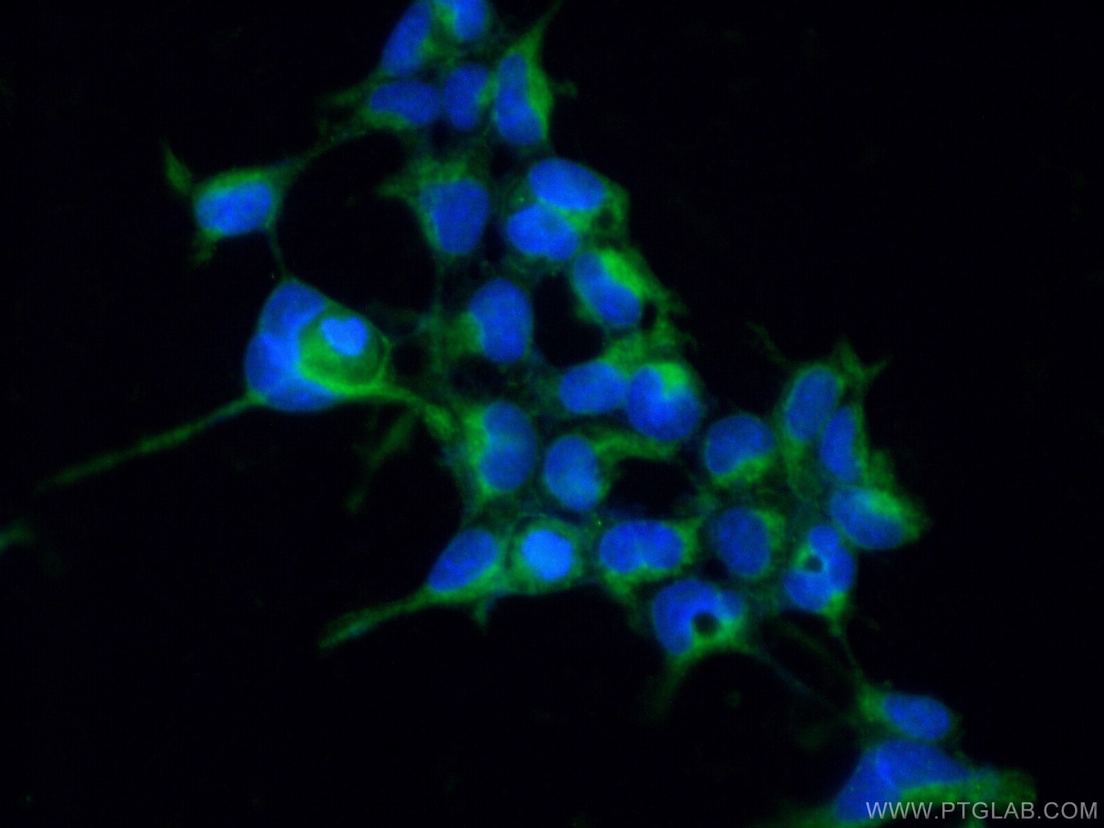 Immunofluorescence (IF) / fluorescent staining of HEK-293 cells using ABLIM1 Polyclonal antibody (15129-1-AP)