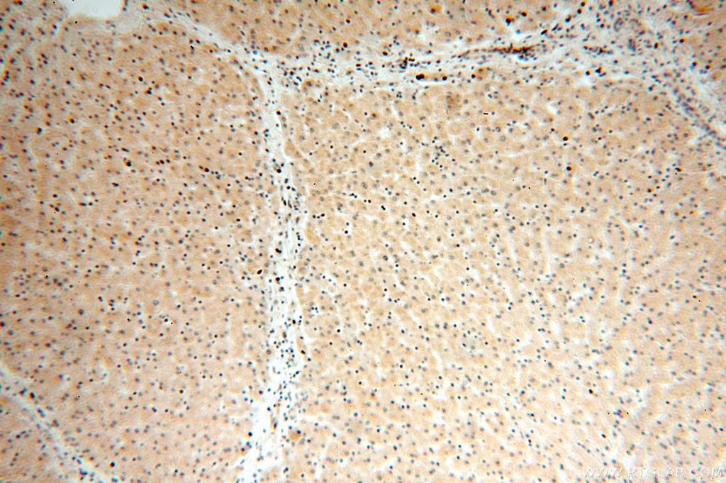 Immunohistochemistry (IHC) staining of human liver tissue using ABLIM1 Polyclonal antibody (15129-1-AP)