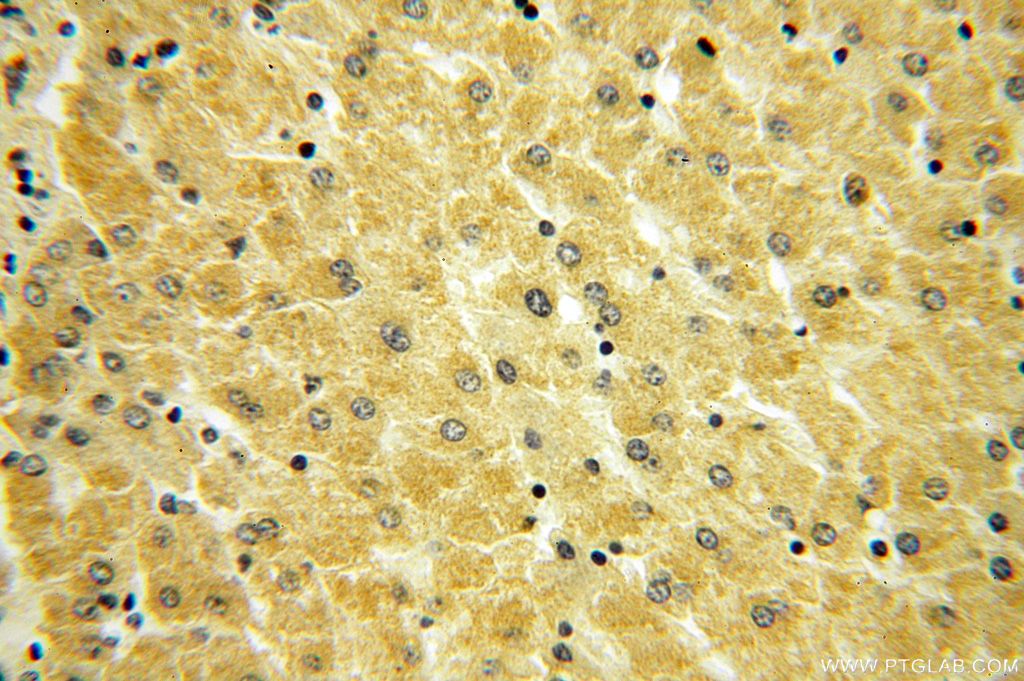 Immunohistochemistry (IHC) staining of human liver tissue using ABLIM1 Polyclonal antibody (15129-1-AP)