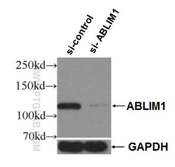 Western Blot (WB) analysis of HeLa cells using ABLIM1 Polyclonal antibody (15129-1-AP)