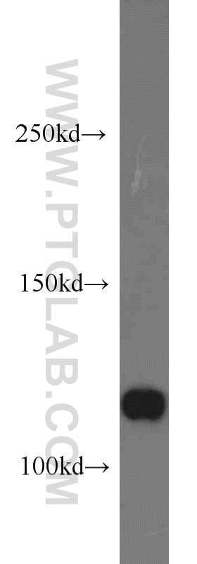 Western Blot (WB) analysis of HEK-293 cells using ABLIM1 Polyclonal antibody (15129-1-AP)