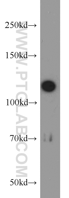 Western Blot (WB) analysis of HeLa cells using ABLIM1 Polyclonal antibody (15129-1-AP)