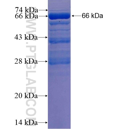 ABLIM1 fusion protein Ag7258 SDS-PAGE