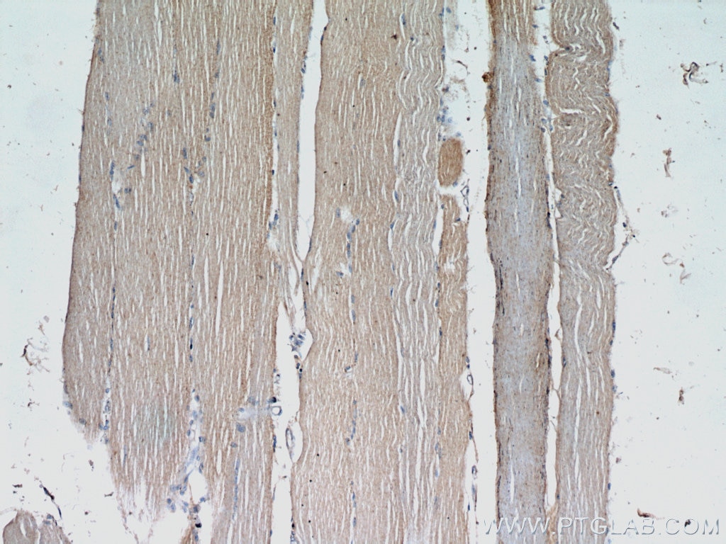 Immunohistochemistry (IHC) staining of human skeletal muscle tissue using ABLIM2 Polyclonal antibody (22433-1-AP)