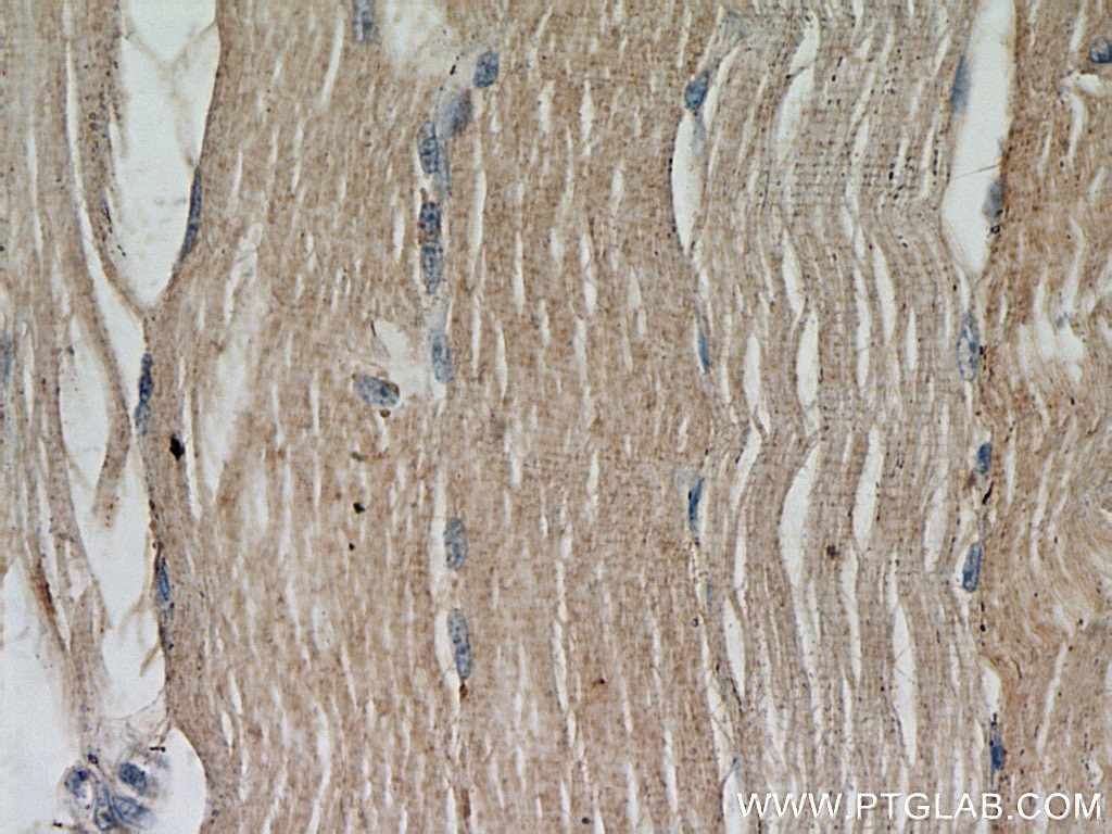 Immunohistochemistry (IHC) staining of human skeletal muscle tissue using ABLIM2 Polyclonal antibody (22433-1-AP)