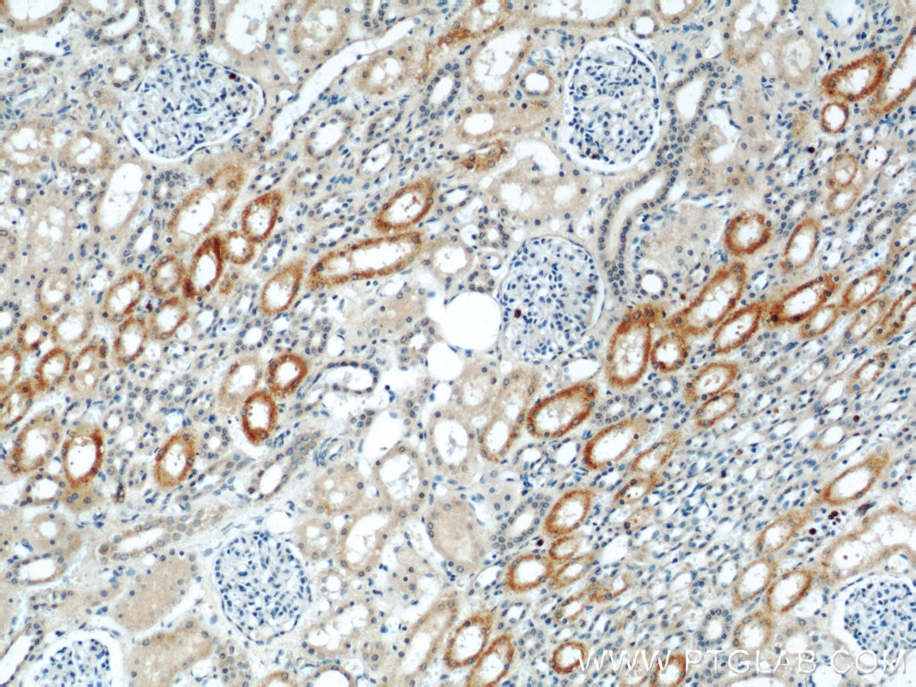 Immunohistochemistry (IHC) staining of human kidney tissue using ABLIM2 Polyclonal antibody (22433-1-AP)