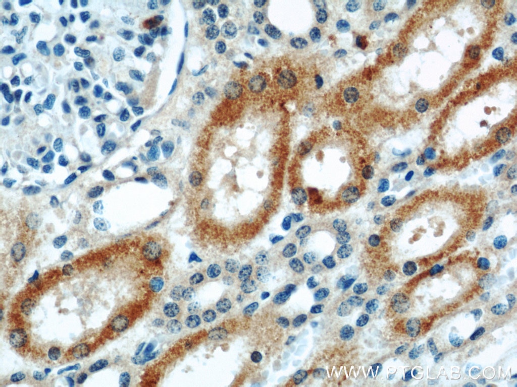 Immunohistochemistry (IHC) staining of human kidney tissue using ABLIM2 Polyclonal antibody (22433-1-AP)