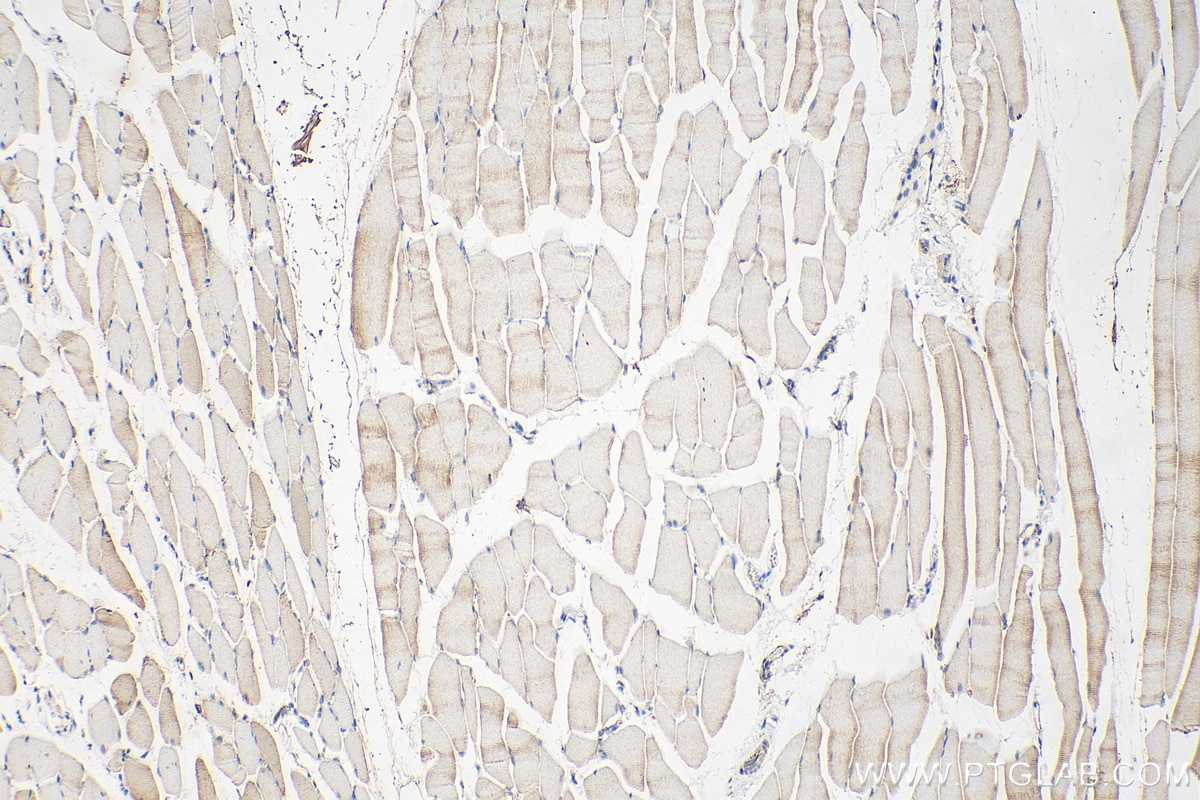 Immunohistochemistry (IHC) staining of mouse skeletal muscle tissue using ABLIM2 Polyclonal antibody (22433-1-AP)