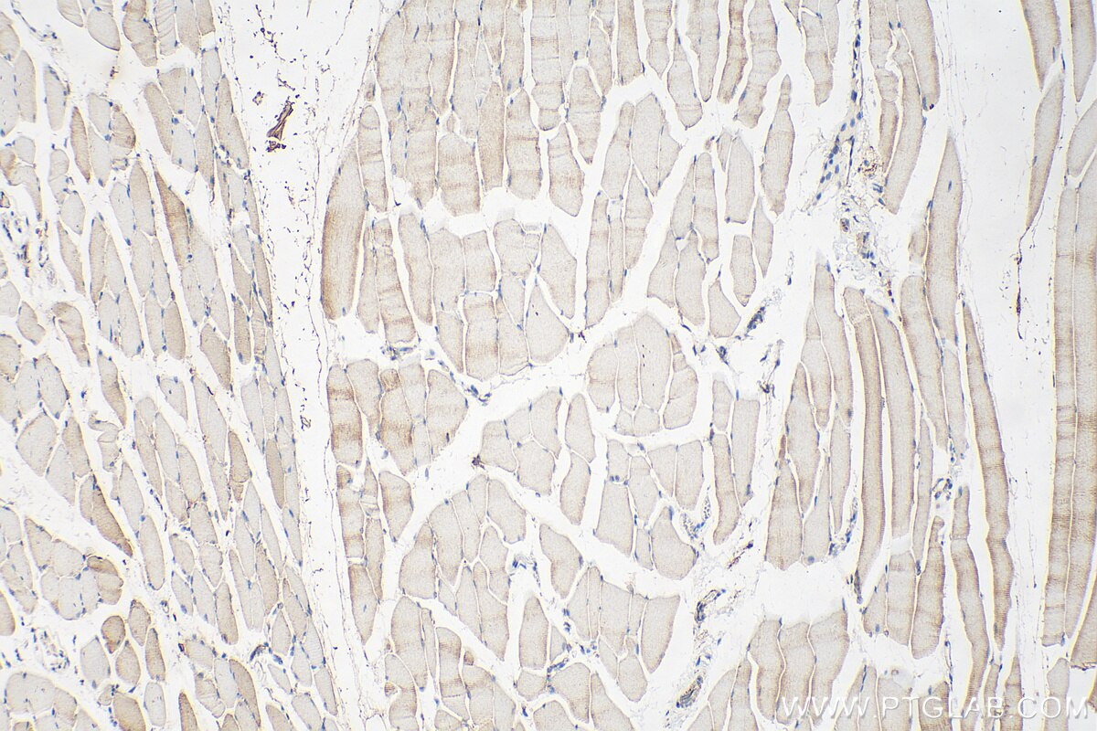 Immunohistochemistry (IHC) staining of mouse skeletal muscle tissue using ABLIM2 Polyclonal antibody (22433-1-AP)