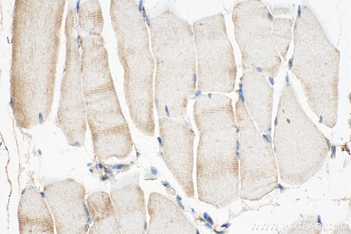 Immunohistochemistry (IHC) staining of mouse skeletal muscle tissue using ABLIM2 Polyclonal antibody (22433-1-AP)