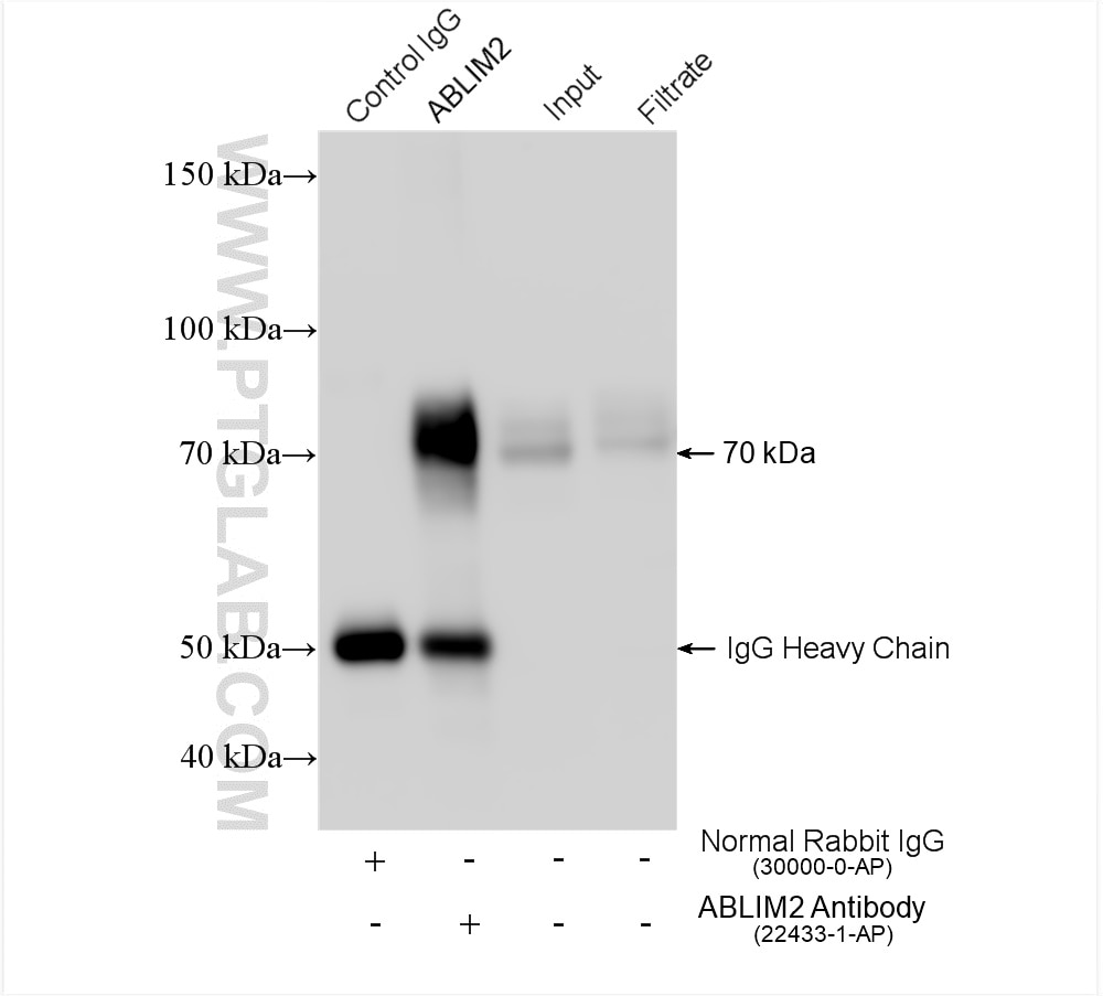 Immunoprecipitation (IP) experiment of mouse brain tissue using ABLIM2 Polyclonal antibody (22433-1-AP)