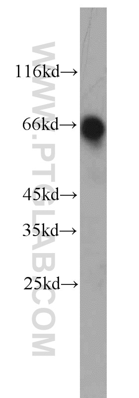 Western Blot (WB) analysis of mouse brain tissue using ABLIM2 Polyclonal antibody (22433-1-AP)