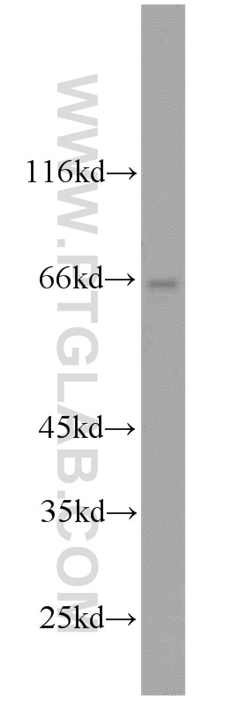 Western Blot (WB) analysis of mouse skeletal muscle tissue using ABLIM2 Polyclonal antibody (22433-1-AP)