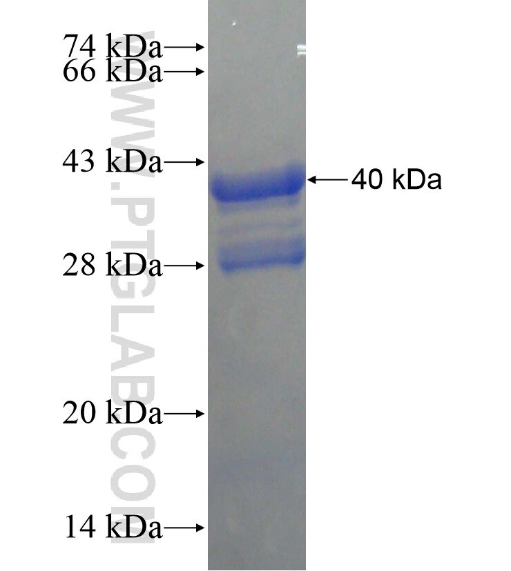 ABLIM2 fusion protein Ag18198 SDS-PAGE