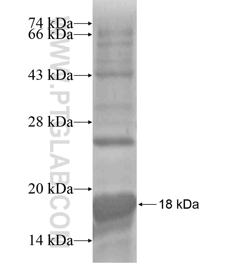 ABLIM2 fusion protein Ag18508 SDS-PAGE