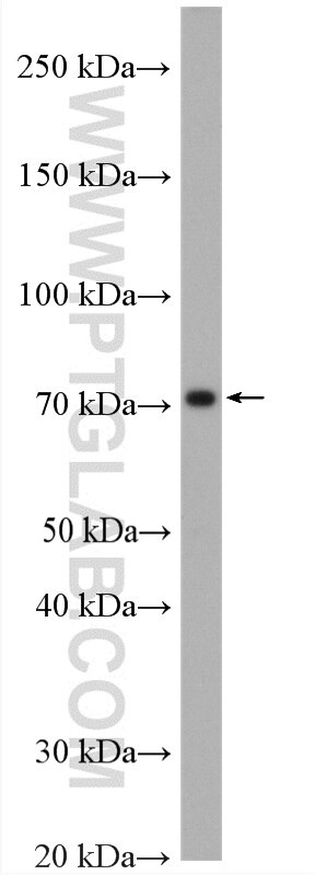 Western Blot (WB) analysis of mouse brain tissue using ABLIM3 Polyclonal antibody (27981-1-AP)