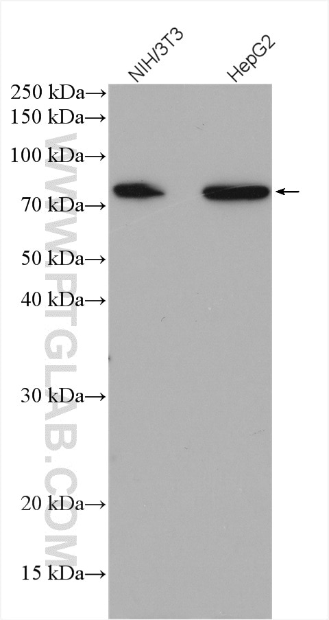 Western Blot (WB) analysis of various lysates using ABLIM3 Polyclonal antibody (27981-1-AP)