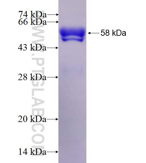 ABLIM3 fusion protein Ag27578 SDS-PAGE