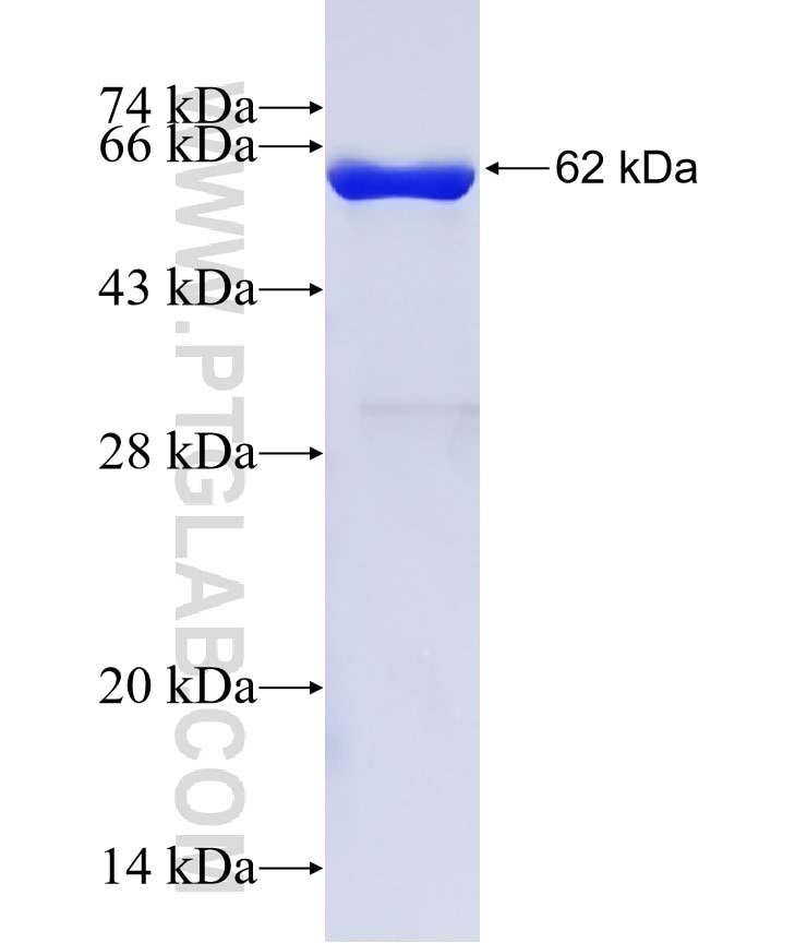 ABO fusion protein Ag15389 SDS-PAGE