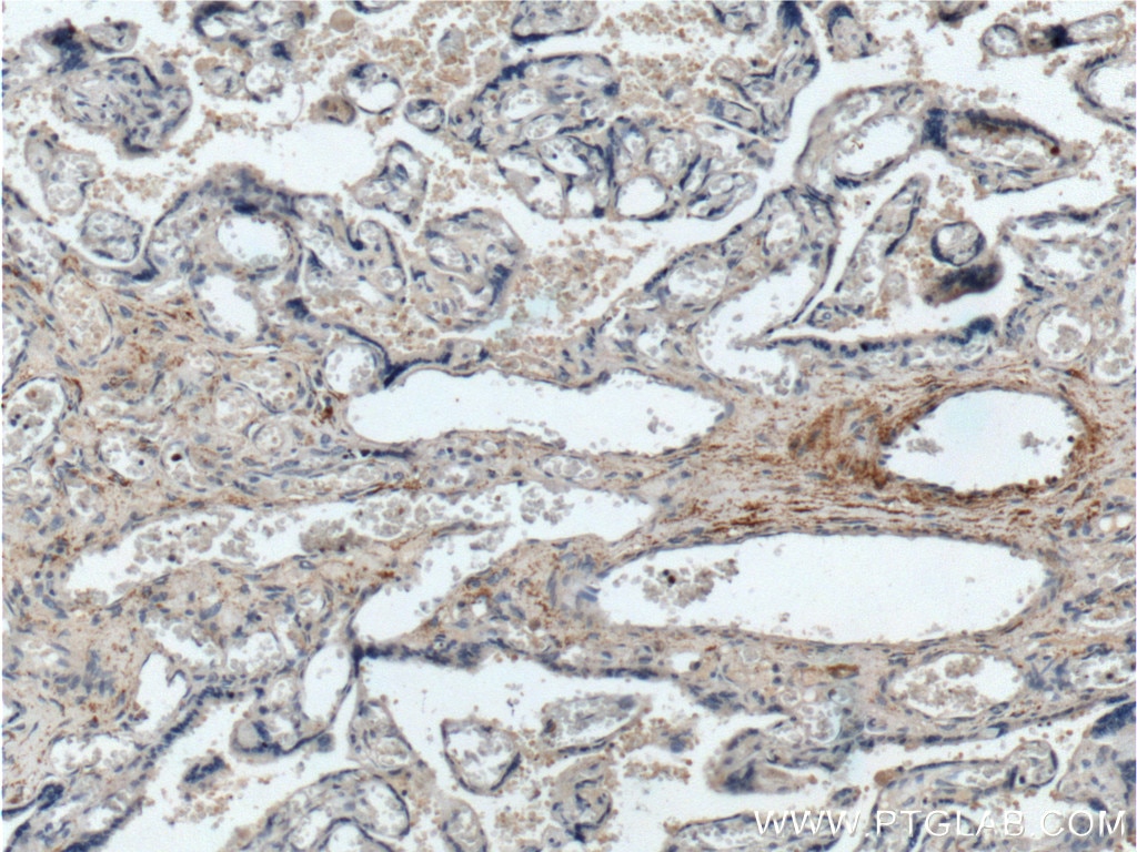 Immunohistochemistry (IHC) staining of human placenta tissue using ABP1 Polyclonal antibody (16338-1-AP)
