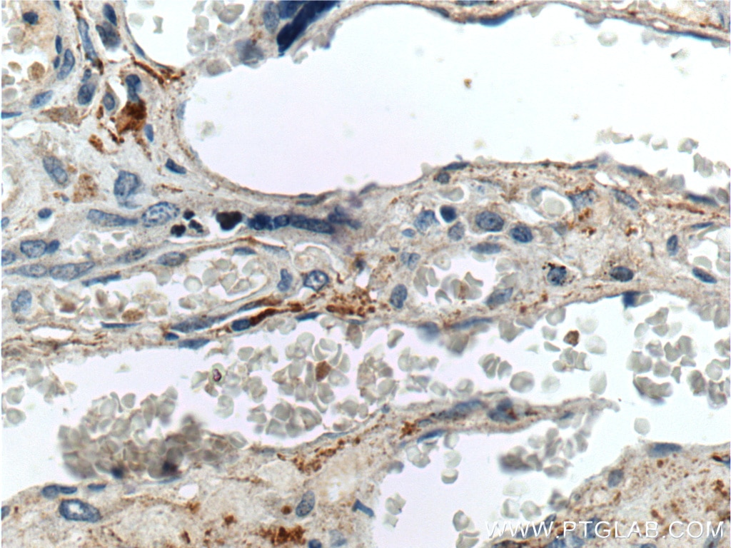 Immunohistochemistry (IHC) staining of human placenta tissue using ABP1 Polyclonal antibody (16338-1-AP)