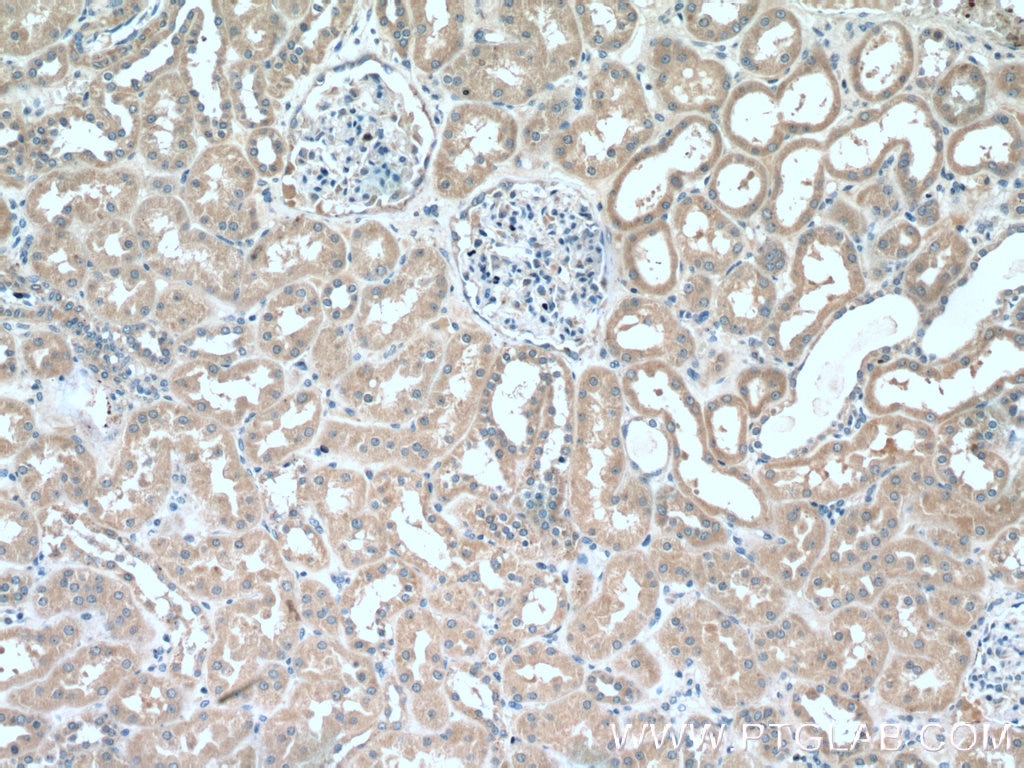 Immunohistochemistry (IHC) staining of human kidney tissue using ABP1 Polyclonal antibody (16338-1-AP)