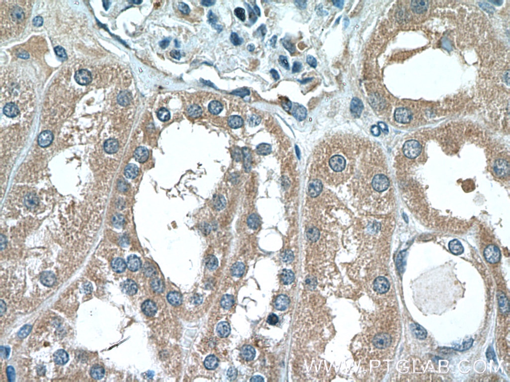 Immunohistochemistry (IHC) staining of human kidney tissue using ABP1 Polyclonal antibody (16338-1-AP)