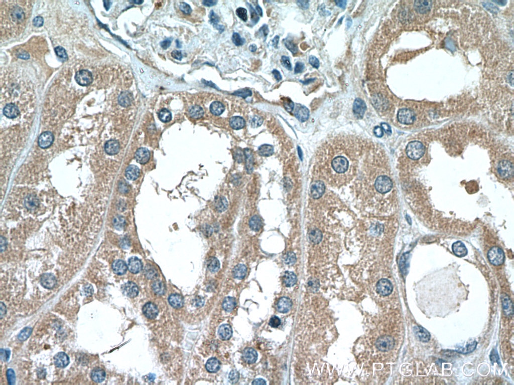 IHC staining of human kidney using 16338-1-AP