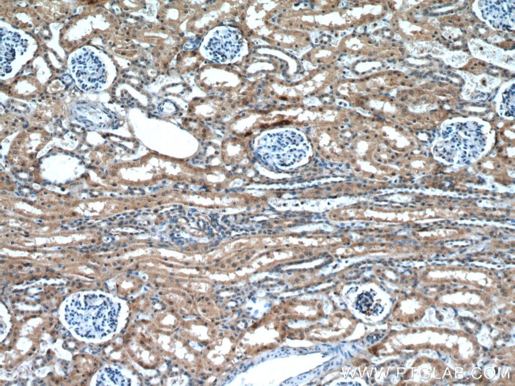 Immunohistochemistry (IHC) staining of human kidney tissue using ABP1 Polyclonal antibody (27814-1-AP)