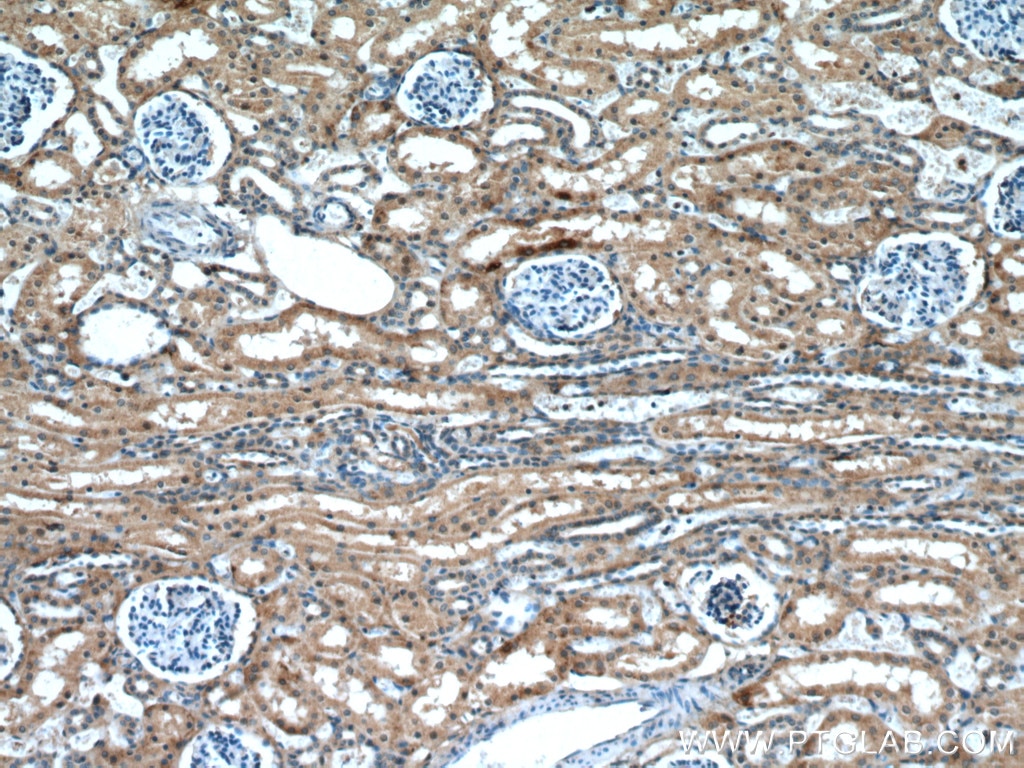 IHC staining of human kidney using 27814-1-AP