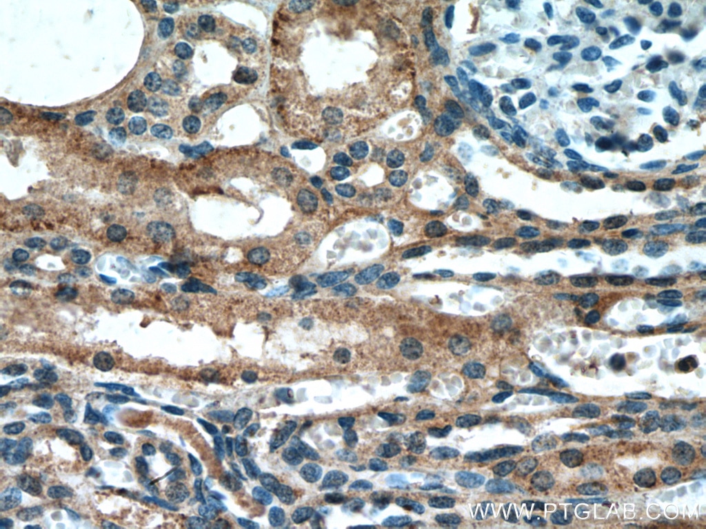 Immunohistochemistry (IHC) staining of human kidney tissue using ABP1 Polyclonal antibody (27814-1-AP)