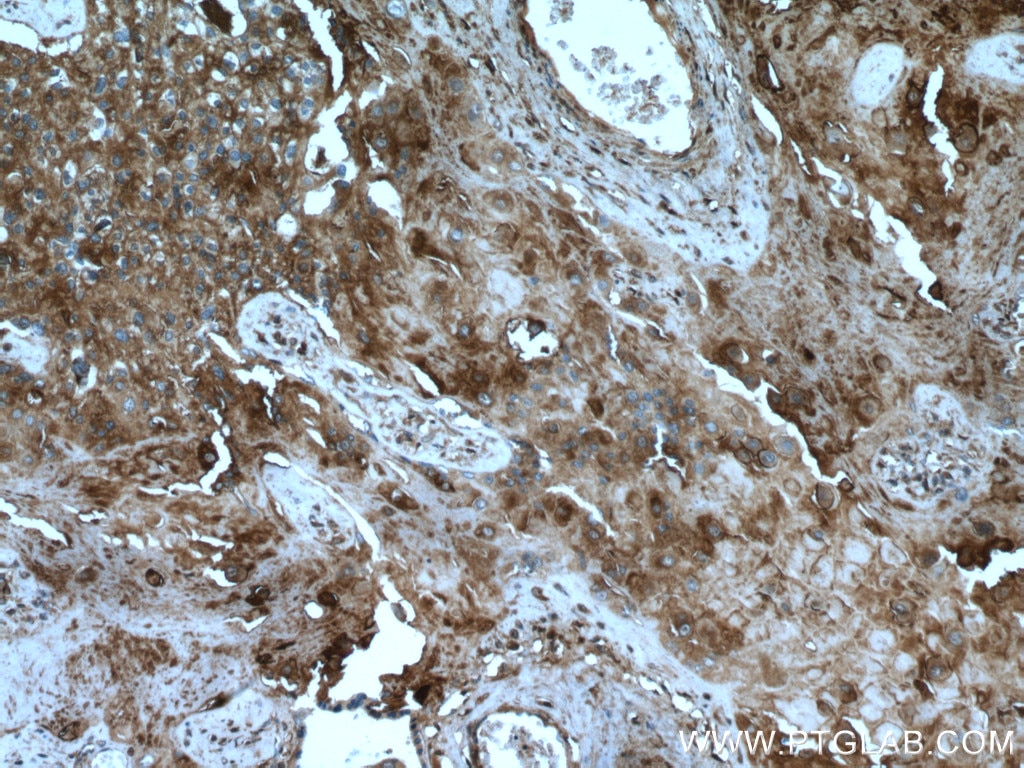 Immunohistochemistry (IHC) staining of human placenta tissue using ABP1 Polyclonal antibody (27814-1-AP)