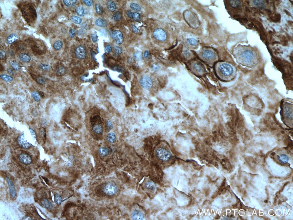 Immunohistochemistry (IHC) staining of human placenta tissue using ABP1 Polyclonal antibody (27814-1-AP)