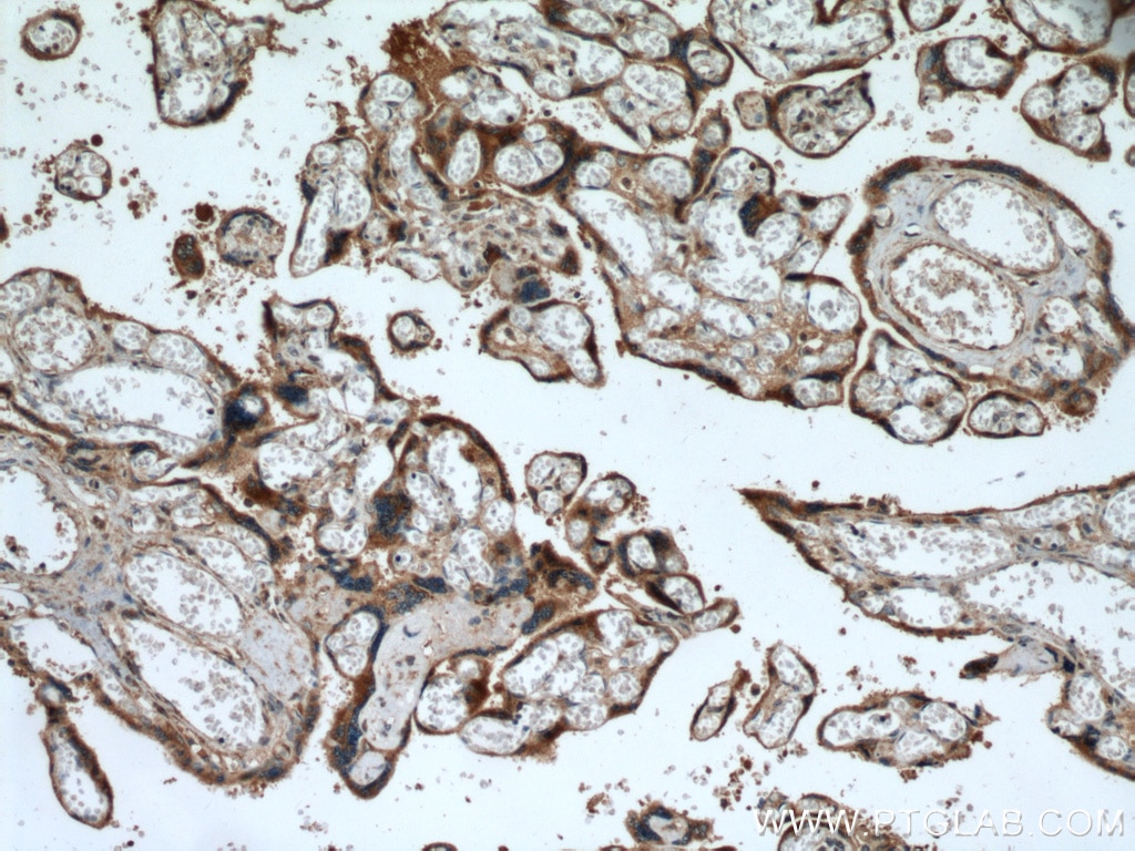 Immunohistochemistry (IHC) staining of human placenta tissue using ABP1 Polyclonal antibody (27814-1-AP)