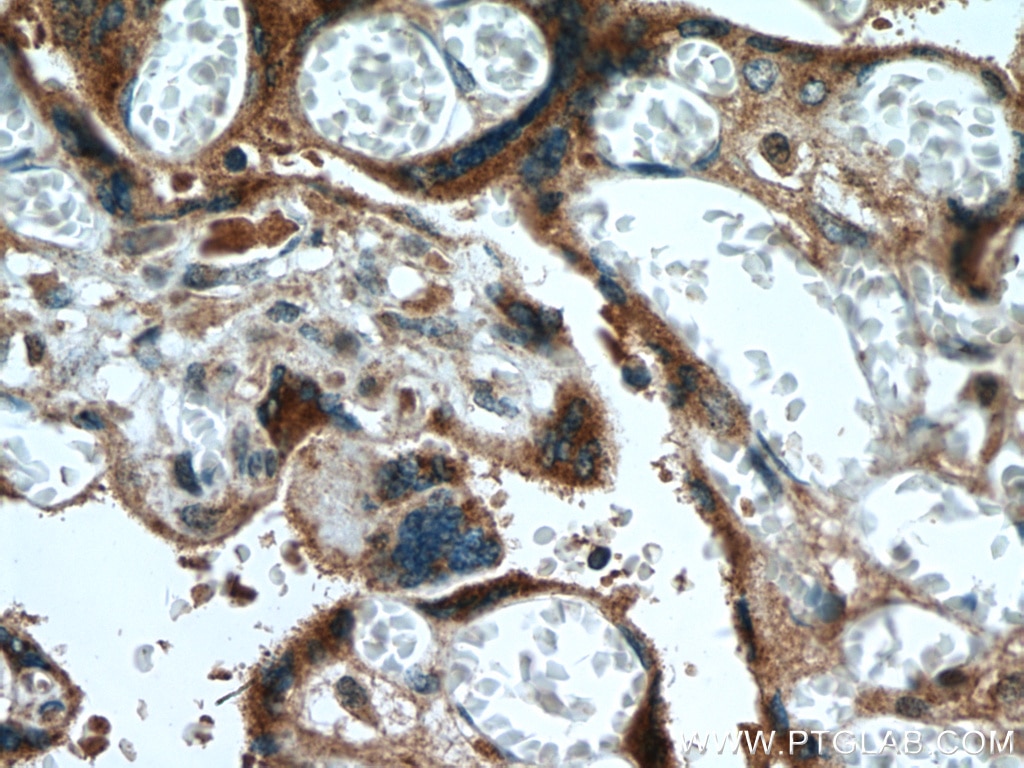 Immunohistochemistry (IHC) staining of human placenta tissue using ABP1 Polyclonal antibody (27814-1-AP)
