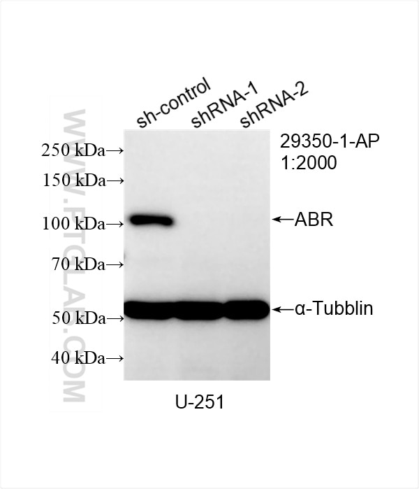 Western Blot (WB) analysis of U-251 cells using ABR Polyclonal antibody (29350-1-AP)