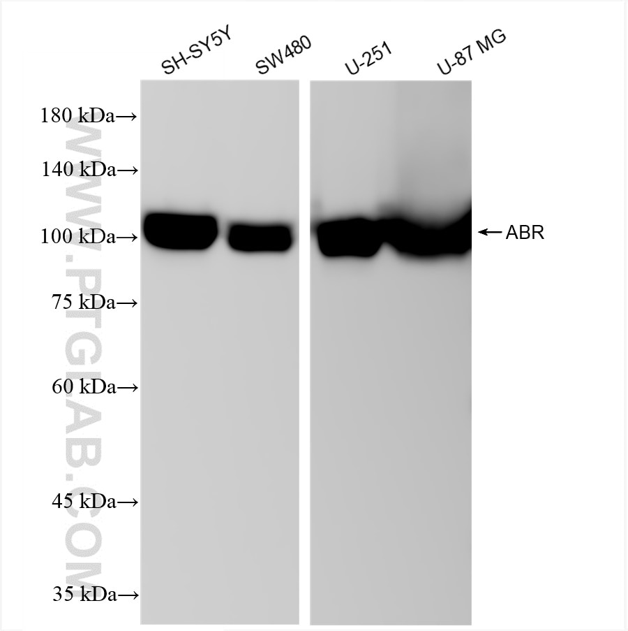 Western Blot (WB) analysis of various lysates using ABR Recombinant antibody (84011-6-RR)