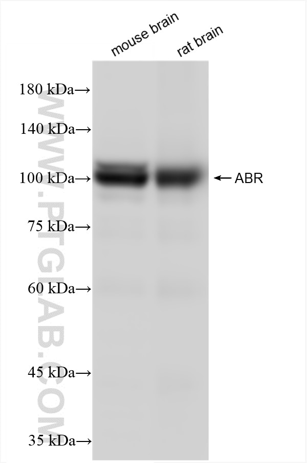 Western Blot (WB) analysis of various lysates using ABR Recombinant antibody (84011-6-RR)