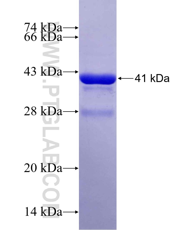 ABR fusion protein Ag29522 SDS-PAGE
