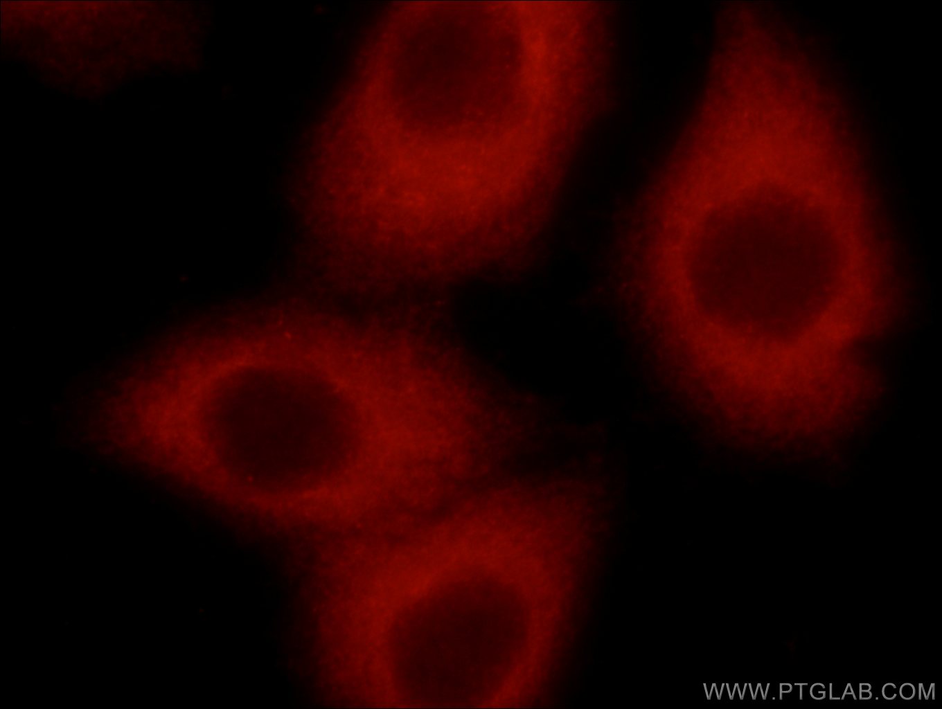 Immunofluorescence (IF) / fluorescent staining of HepG2 cells using STARS/ABRA Polyclonal antibody (22673-1-AP)