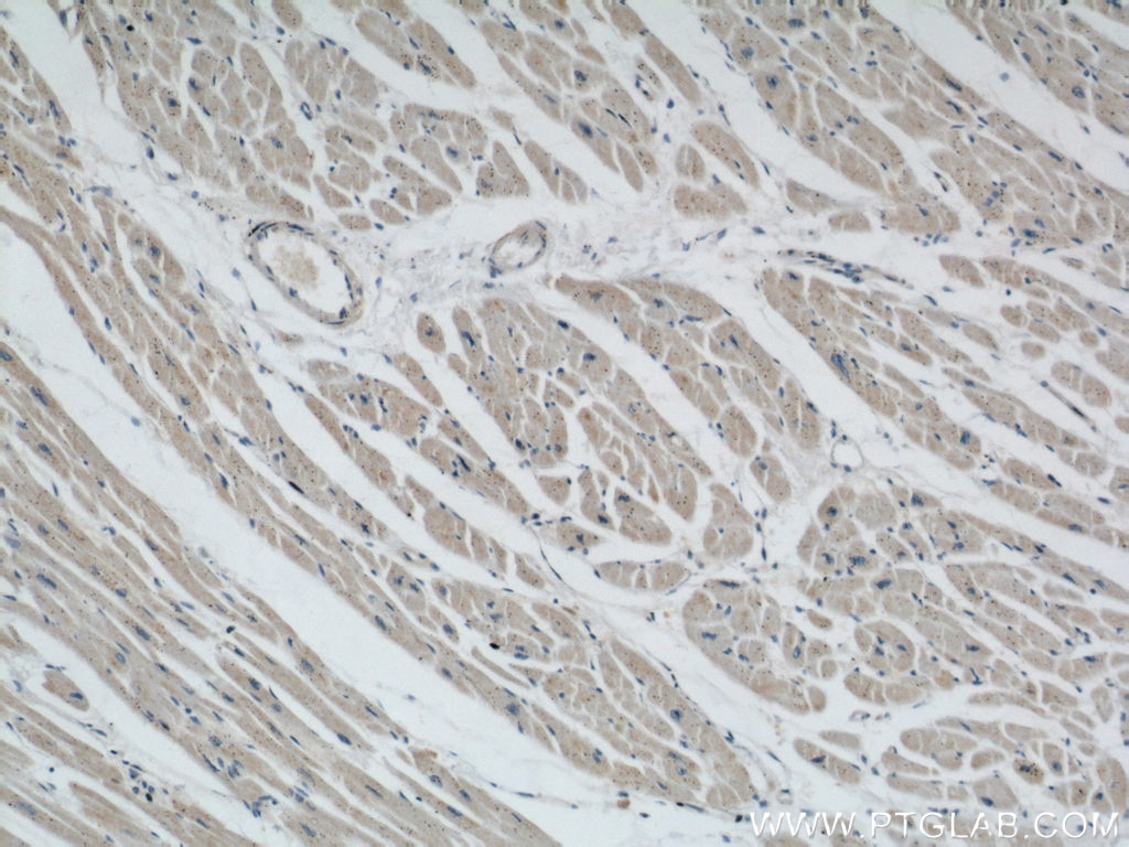 Immunohistochemistry (IHC) staining of human heart tissue using STARS/ABRA Polyclonal antibody (22673-1-AP)