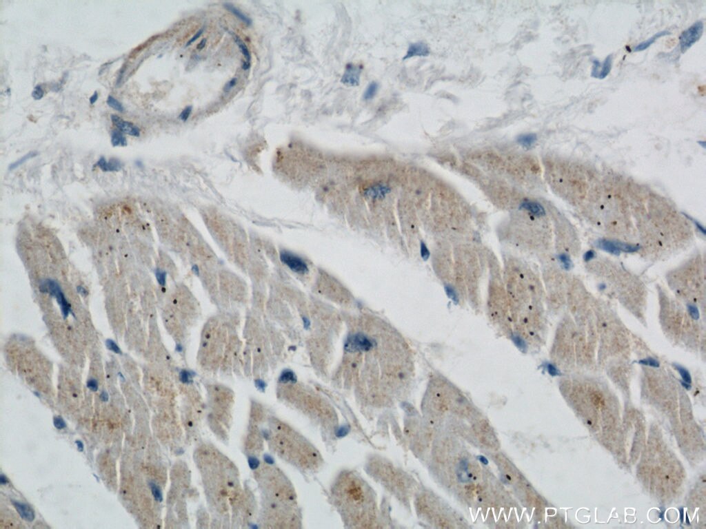 Immunohistochemistry (IHC) staining of human heart tissue using STARS/ABRA Polyclonal antibody (22673-1-AP)