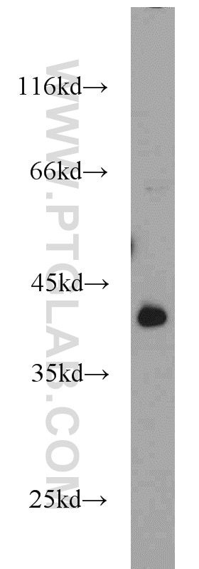Western Blot (WB) analysis of mouse heart tissue using STARS/ABRA Polyclonal antibody (22673-1-AP)